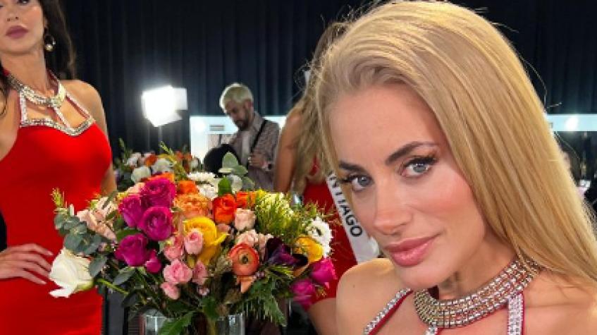 Catalina Palacios responde con ironía a críticas por retoque estético: "Si antes amaba usar ácido hialurónico..."