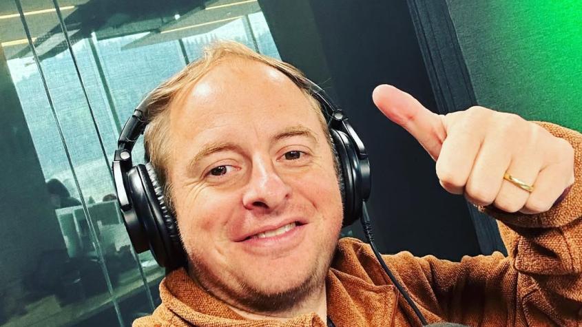 “Este era yo sin pelo": Coke Hevia compartió su antes y después tras tratamiento contra la pérdida de cabello 