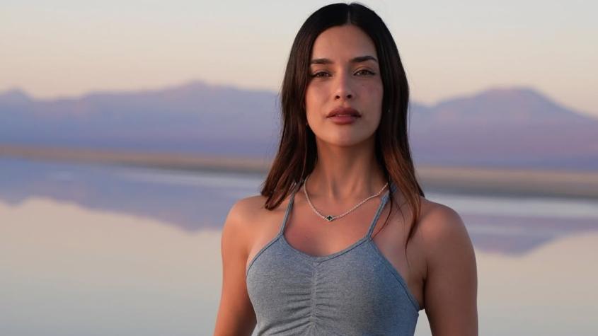 Camilísima confesó íntima "malformación" que la acomplejó durante su adolescencia: "Todavía me pesa"