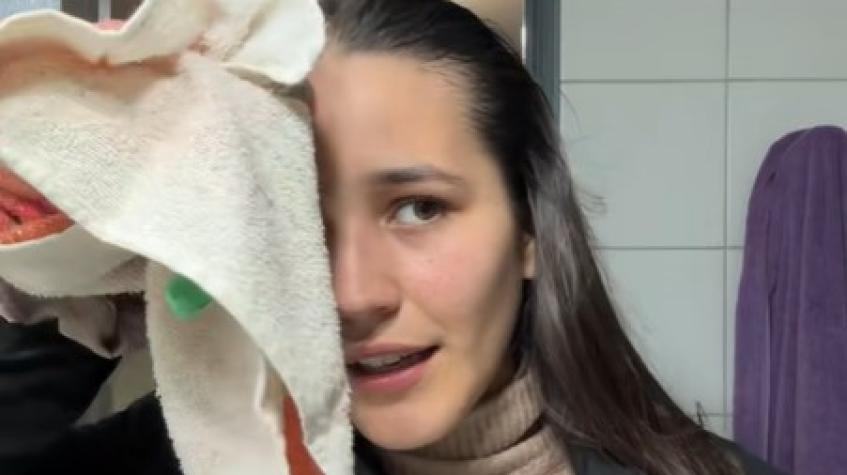 Actriz nacional sufre grave accidente deportivo: contó detalles de cómo su frente se deformó tras un choque