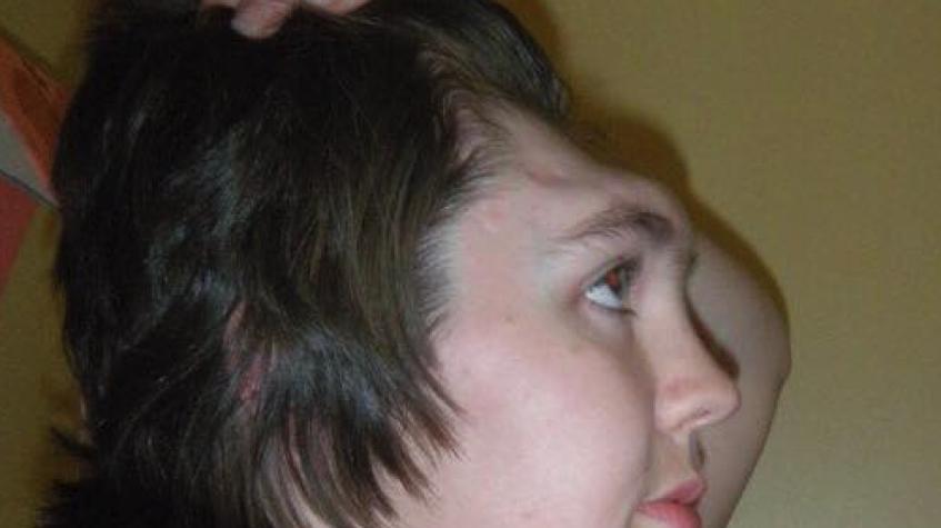 La historia de la mujer que perdió la frente por chocar cuando llevaba los pies sobre el tablero