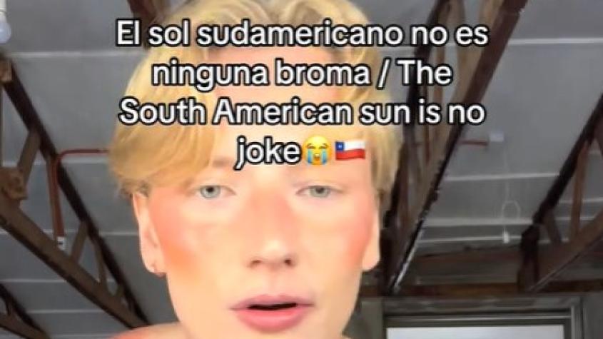 "El sol en Chile no es ninguna broma": Influencer finlandés muestra cómo se quemó por no usar protector solar