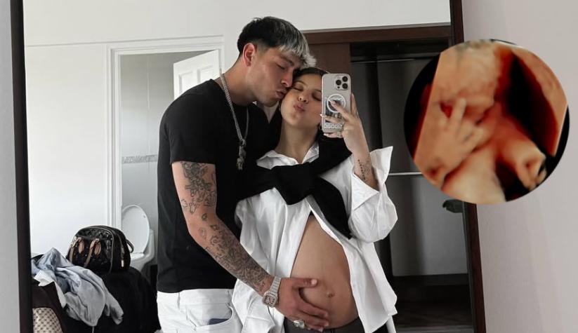 Ignacia Antonia comparte el momento más divertido y tierno de su bebé durante una ecografía