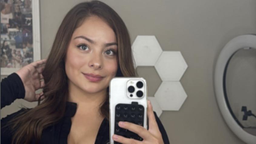 Revelan el antes y después de Skarleth Labra tras someterse a retoque estético facial