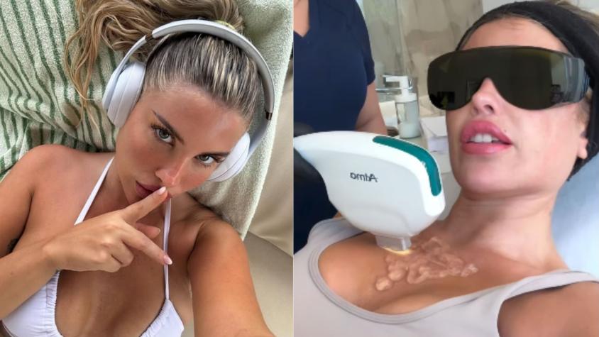 Coté López sorprendió al mostrar el tratamiento estético que se realizó en una curiosa zona de su cuerpo