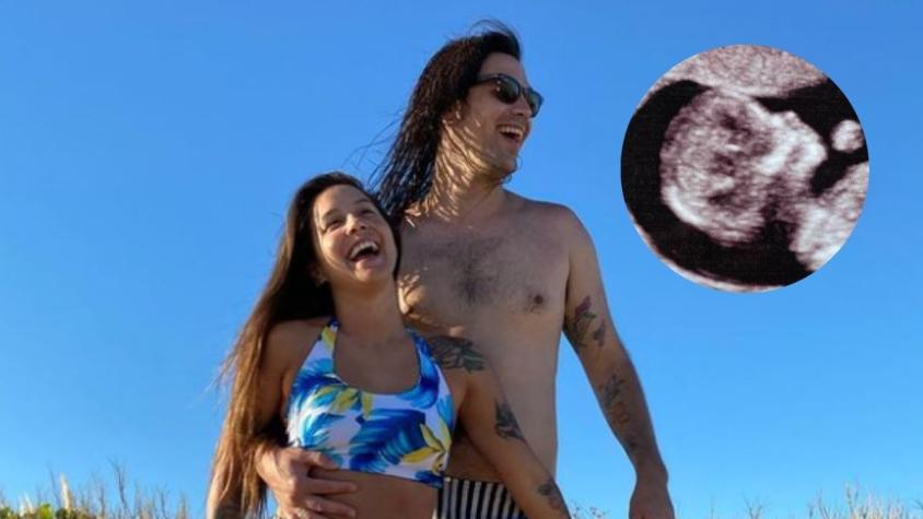 Exmarido de Denise Rosenthal se ve obligado a vender su auto por embarazo de su pareja actriz