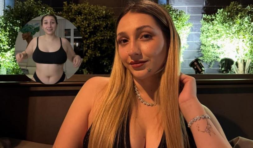 Las fotos del impactante cambio físico de Carlita tras cirugía estética en Miami: el procedimiento costaría desde $7 millones