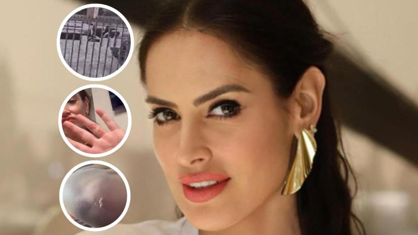Instagram - Adriana Barrientos sufre violento portonazo