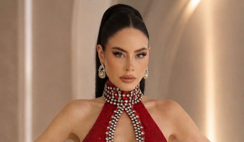 Ignacia Michelson revela que se sometió a una operación: mostró cómo quedó Ignacia Michelson revela que se sometió a una operación: mostró cómo quedó