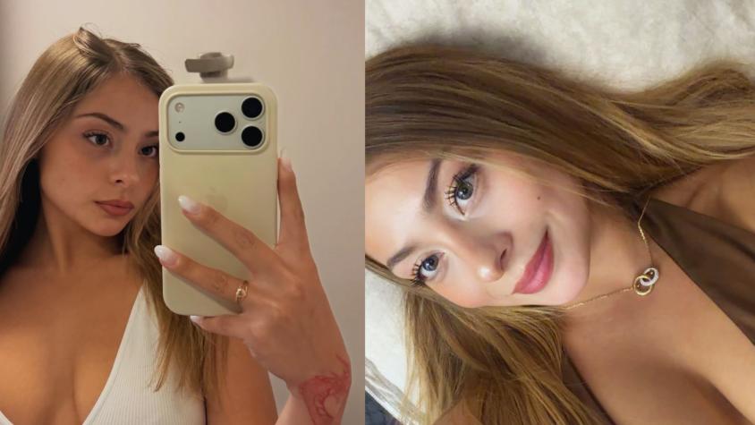 ¡Impresionó! Skarleth Labra comparte fotos de su transformación física: “Hasta la cara…” ¡Impresionó! Skarleth Labra comparte fotos de su transformación física: “Hasta la cara…”