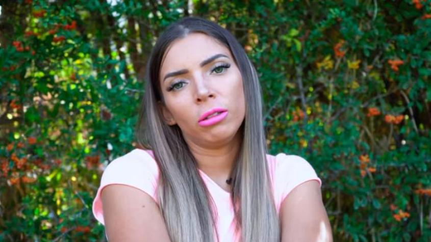 Redes Sociales - Geri Hoops reaparece y hace desesperado llamado tras complicaciones en su rostro