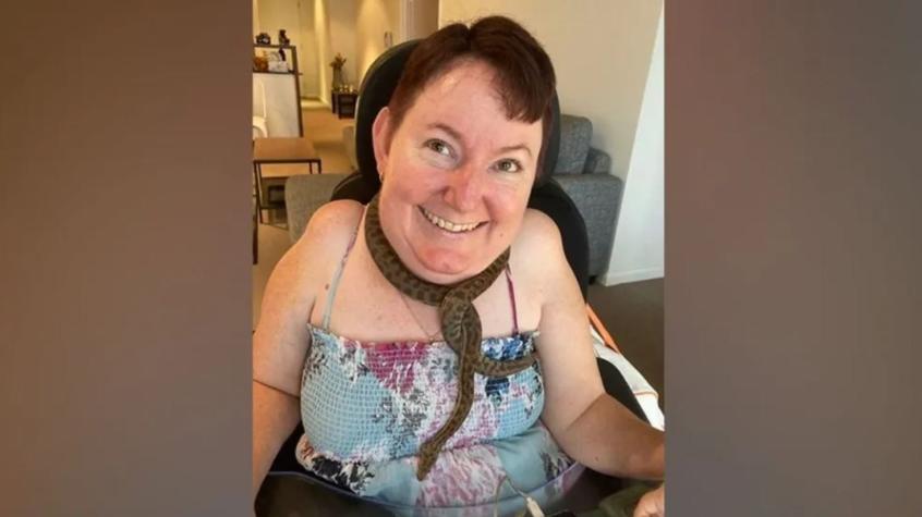 “No tenía idea de lo que me esperaba": Mujer de 43 años con discapacidad contrató a un hombre para tener sexo por primera vez