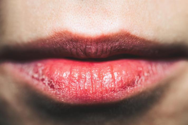 Labios resecos: 7 remedios caseros muy fáciles de hacer