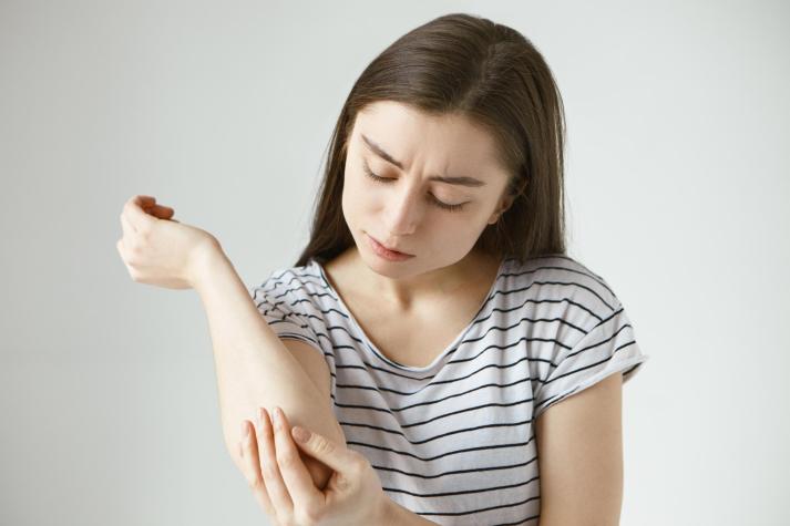 ¿Qué es la dermatitis atópica? 7 síntomas para identificarla