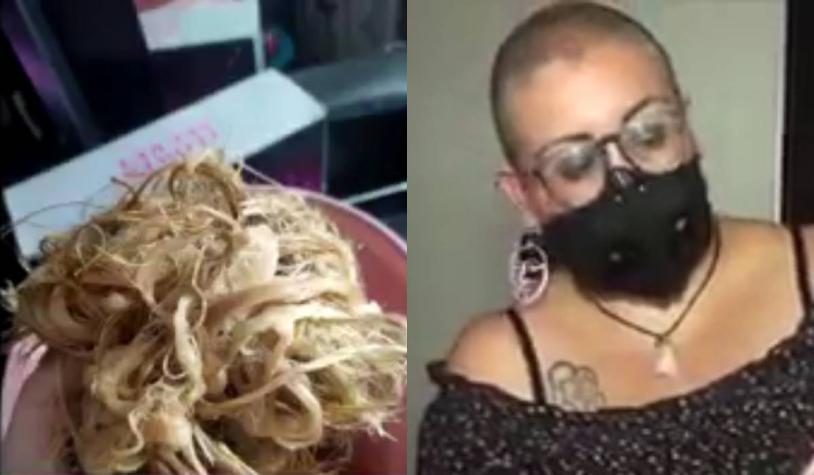 Mujer perdió su cabello tras aplicarse un producto para alisar: “me lo quemó”