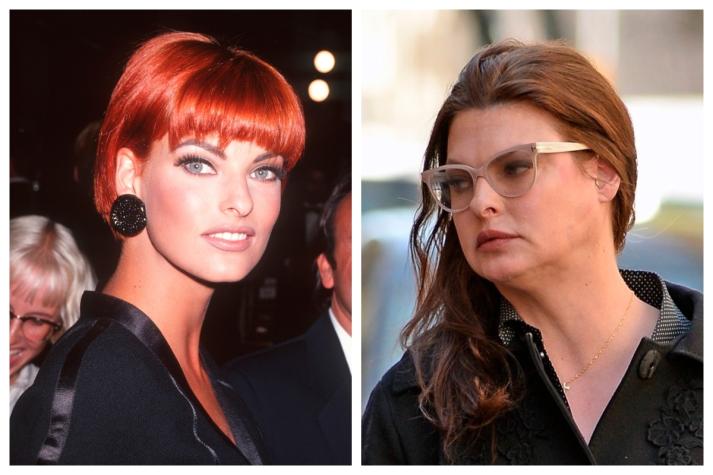 Hiperplasia Adiposa: La razón por la que Linda Evangelista luce “irreconocible”