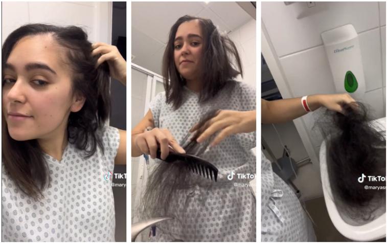 ¡Impactante! Joven grafica la caída del cabello por quimioterapia en video de TikTok