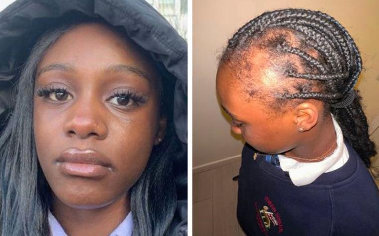 Joven de 14 años sufrió ataque de sus compañeros quienes le arrancaron el cabello
