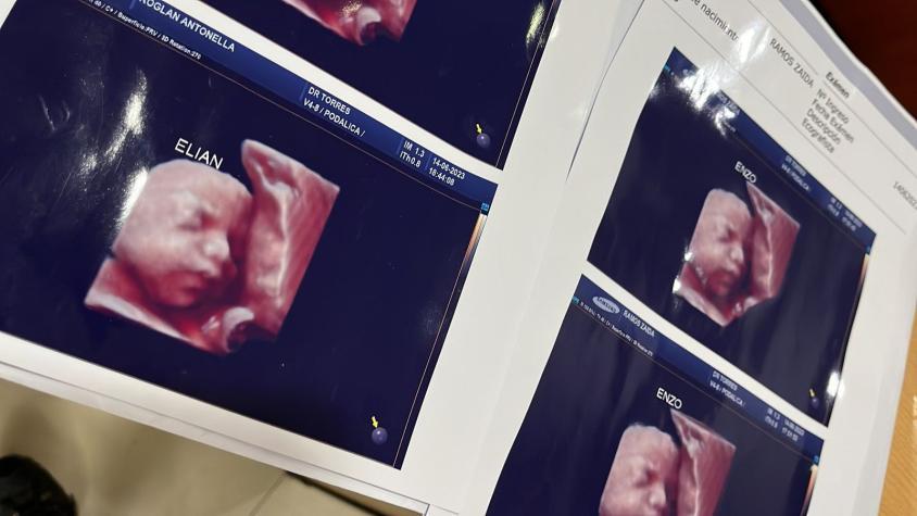 Denuncian a clínica privada: Utilizaban la misma ecografía 5D para todas las embarazadas
