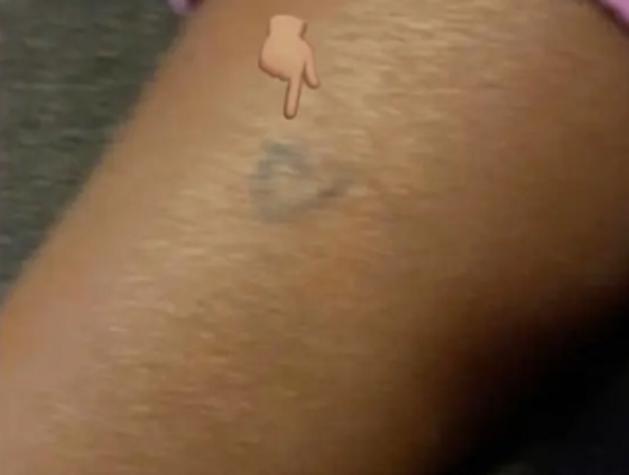 Mujer tatuó a su sobrina de siete años sin la autorización de la madre