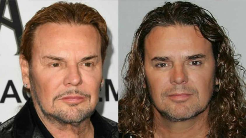 Famosos que lucen irreconocibles con las cirugías estéticas