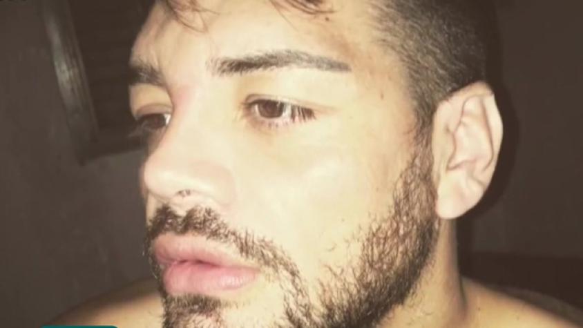 Fran Mariano se ha realizado 27 cirugías para parecerse a Ricky Martin