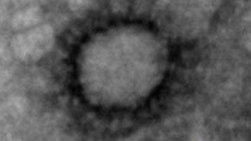 Científicos argentinos registran la primera fotografía del coronavirus