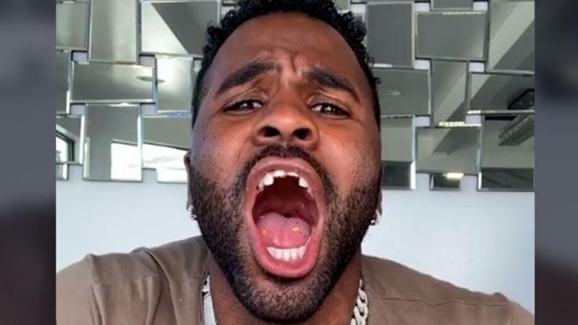 Cantante Jason Derulo realiza reto TikTok y aparentemente queda sin dientes