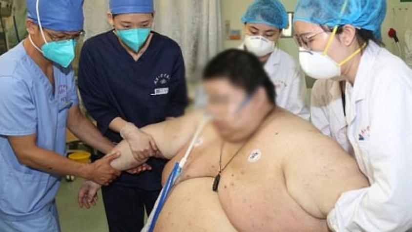 Hombre engordó 100 kilos tras pasar cinco meses en cuarentena