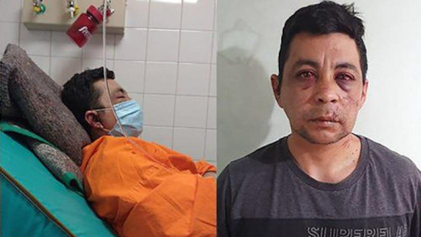 Vecinos golpean e incendian casa de enfermero recuperado de coronavirus