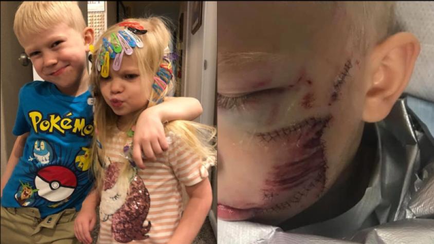 Niño de 6 años arriesgó la vida para salvar a su hermana de fatal ataque