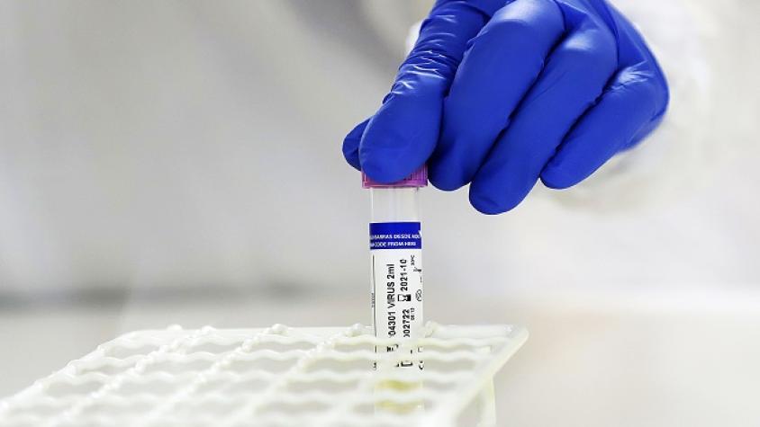 Coronavirus: estaría mutando y podría esquivar la inmunidad