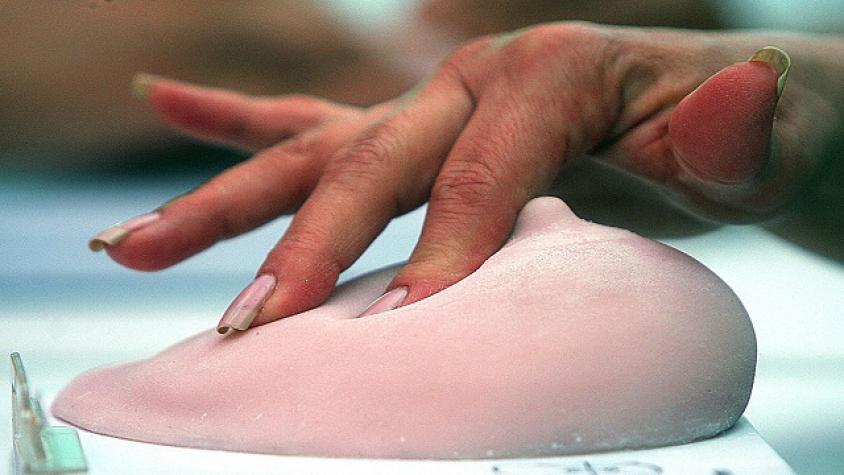 Mamografía ¿Por qué es tan importante este examen? 