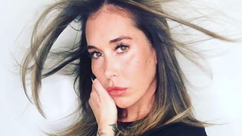 Vale Roth se inyectó bótox y mostró el paso a paso en video