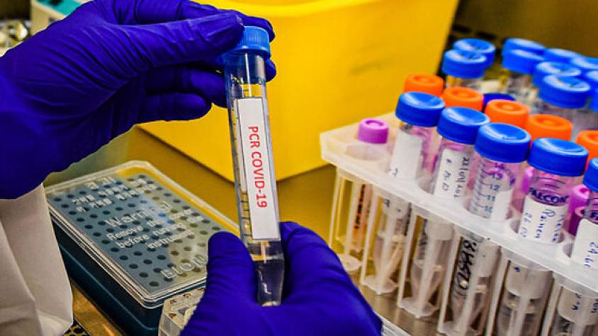 Ministerio de Salud reportó 6.836 nuevos casos de Covid-19 en el país