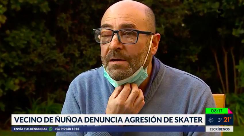 Vecino de Ñuñoa denuncia agresión de skater