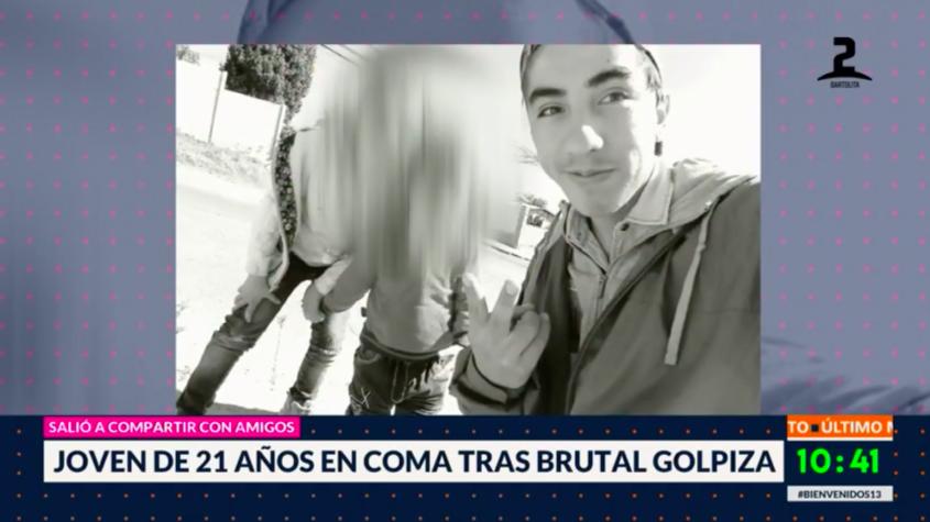 Joven de 21 años en coma tras brutal golpiza