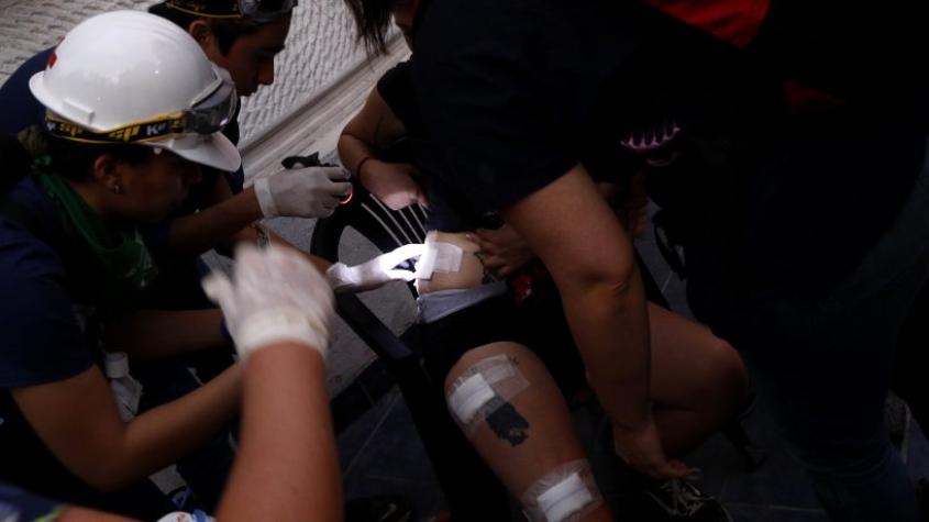 Víctimas de Trauma ocular y lesiones graves: anuncian fortalecimiento en los programas de atención médica