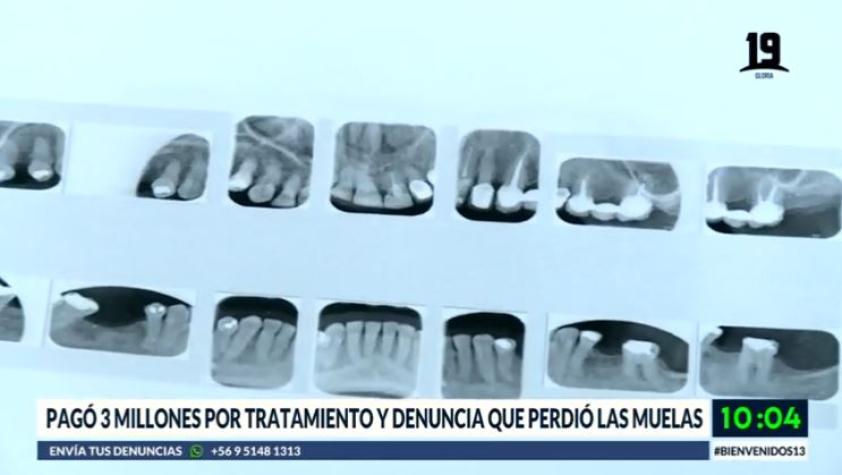 Mujer denuncia que negligencia dental le hizo perder sus muelas