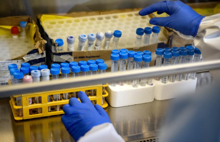 Cierran laboratorio en Inglaterra por 43 mil PCR erróneos: todas dieron negativo