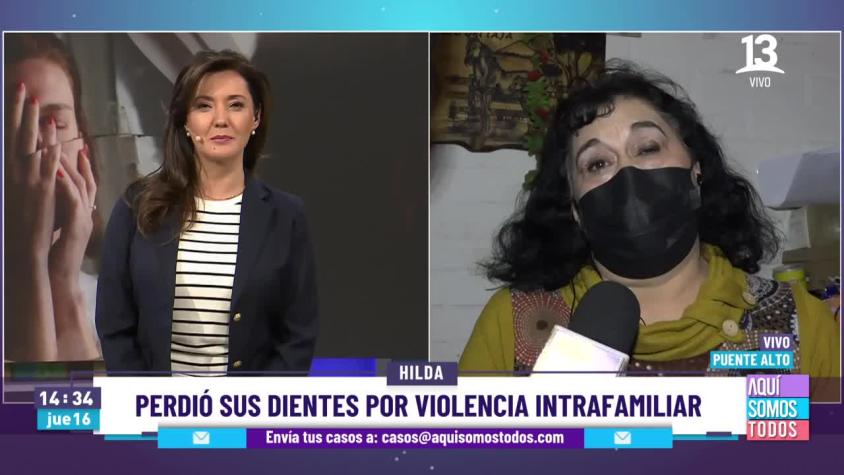 Hilda lleva 30 años sin sonreír.