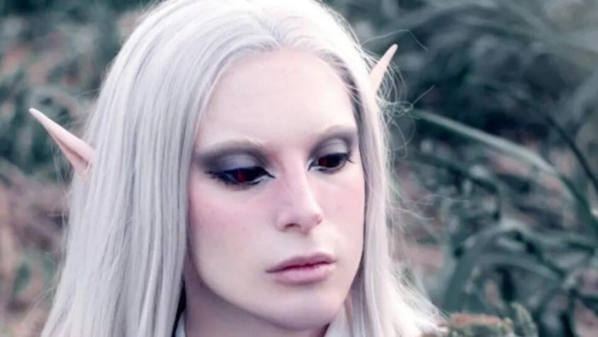 ¿Legolas? Hombre gastó más de 85 mil dólares en operaciones para parecerse a un elfo