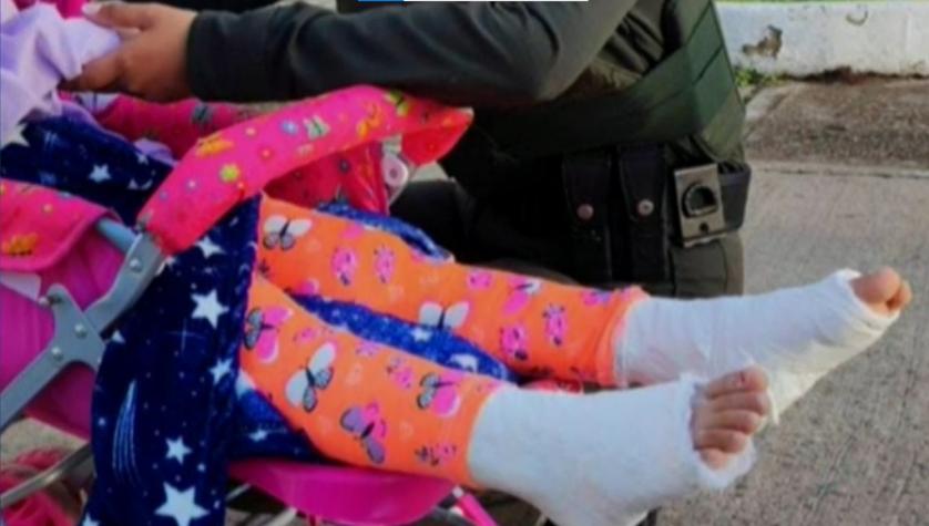 "No tenía lesión": Mujer fue detenida por enyesar a su hija de 7 años y pedir limosna
