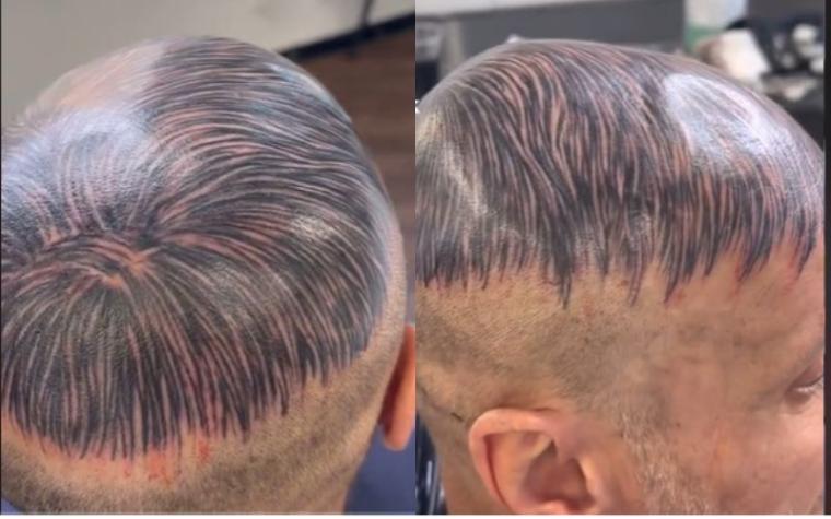 Se volvió viral: Hombre decidió tatuarse la cabeza para fingir que tiene cabello 