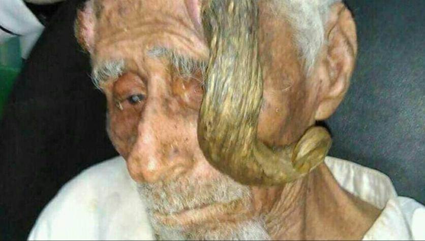  Hombre "más viejo del mundo" murió a sus 140 años tras sacarle sus cuernos