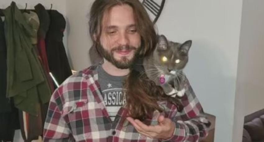 Hombre sufrió la amputación de sus manos y parte de sus pies por culpa de una pulga