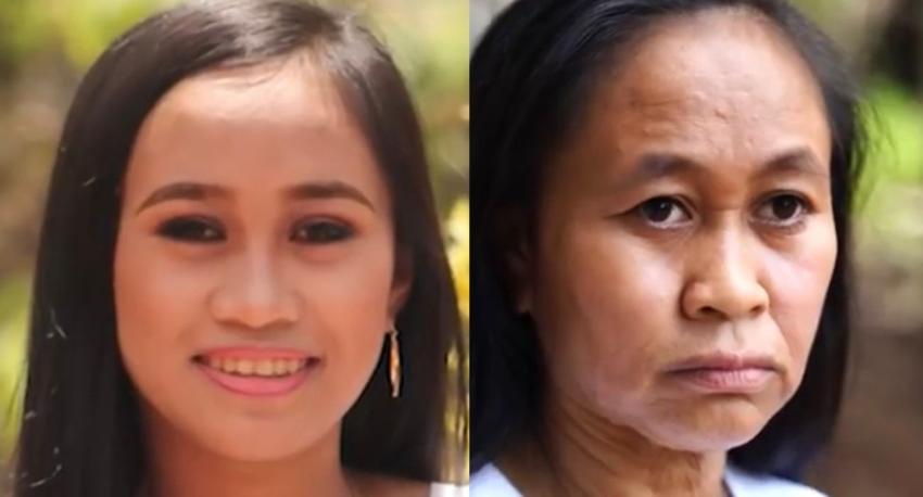 Joven filipina cumplió 18 años pero parece de 50: esta es la enfermedad que padece