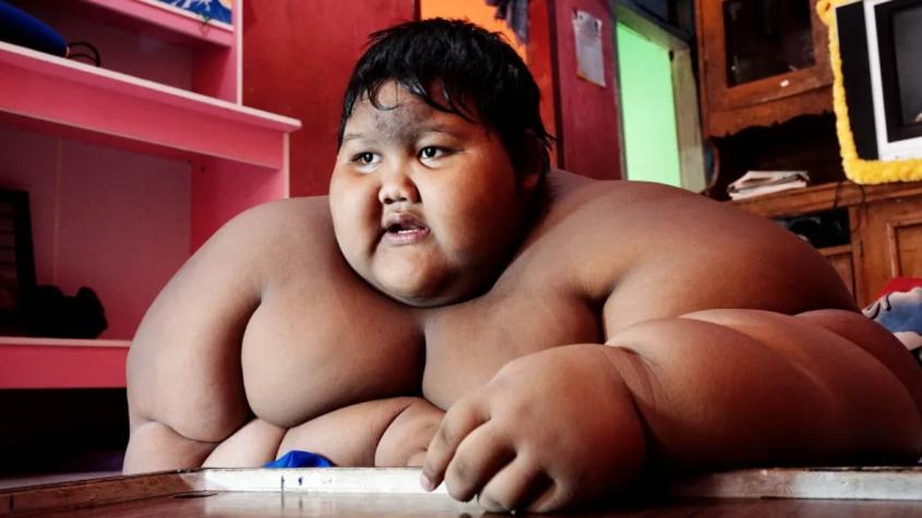 "El niño más gordo del mundo" - Créditos: The Sun - Getty Images