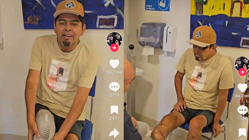 Mauricio “El Indio” Medina emociona al compartir su proceso de rehabilitación tras sufrir amputación de parte de su pierna