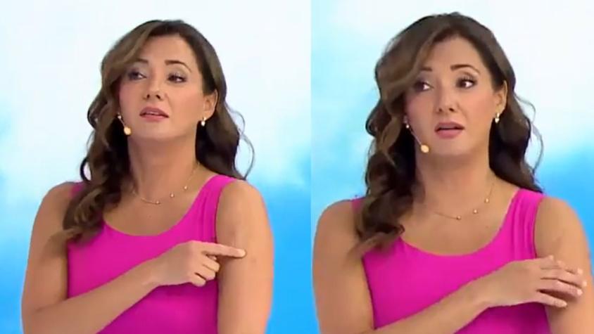 Priscilla Vargas muestra la cicatriz del tumor que tuvo en su brazo: "Me lo maquillaba"